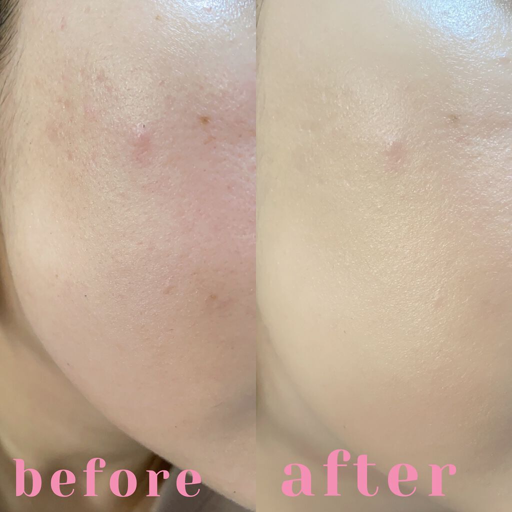 プロポリスアンプルインクッション/CNP Laboratory/クッションファンデーションを使ったクチコミ(4枚目)