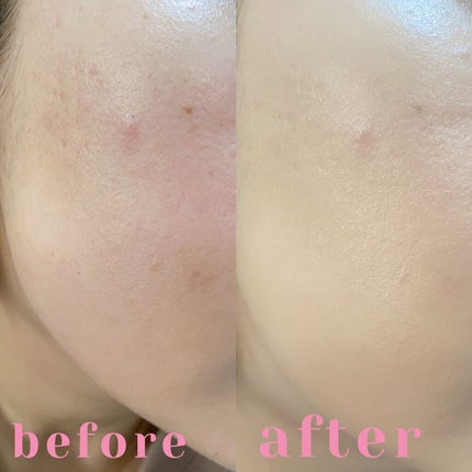 プロポリスアンプルインクッション/CNP Laboratory/クッションファンデーションを使ったクチコミ(4枚目)