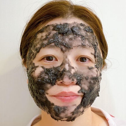 ニードル炭酸パック/NNE/洗い流すパック・マスクを使ったクチコミ(5枚目)