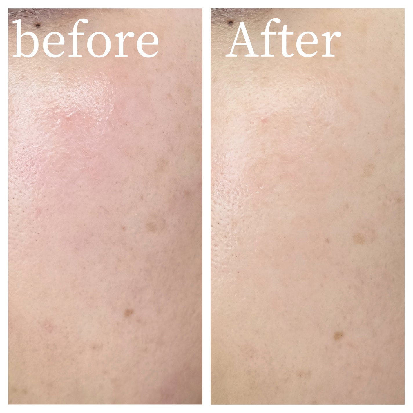 ハイドロセラノールリアルディープマスク/Biodance/シートマスク・パックを使ったクチコミ(4枚目)