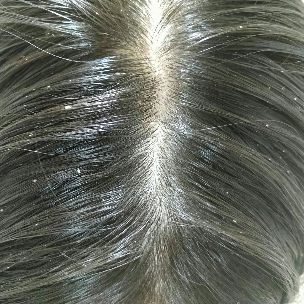 柳屋　あんず油/柳屋あんず油/ヘアオイルを使ったクチコミ（3枚目）