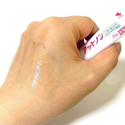 ニキビあとケアジェル/アットノン/その他スキンケアを使ったクチコミ(5枚目)