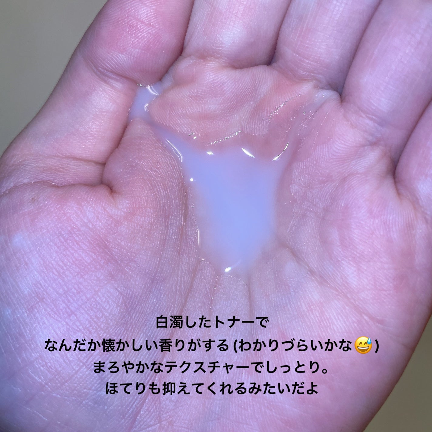 薬用スキンコンディショナーエッセンシャル N/ALBION/化粧水を使ったクチコミ(5枚目)