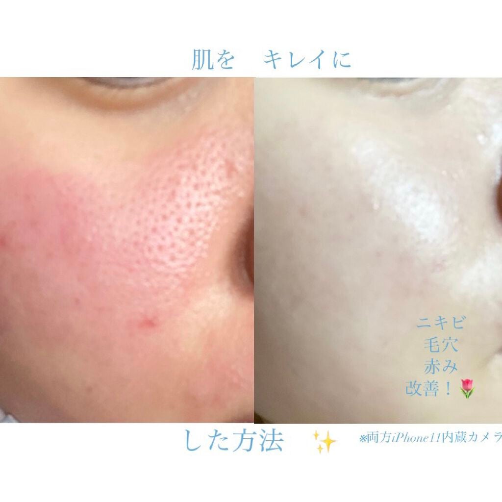 ハトムギ保湿ジェル(ナチュリエ スキンコンディショニングジェル)/ナチュリエ/美容液を使ったクチコミ(1枚目)