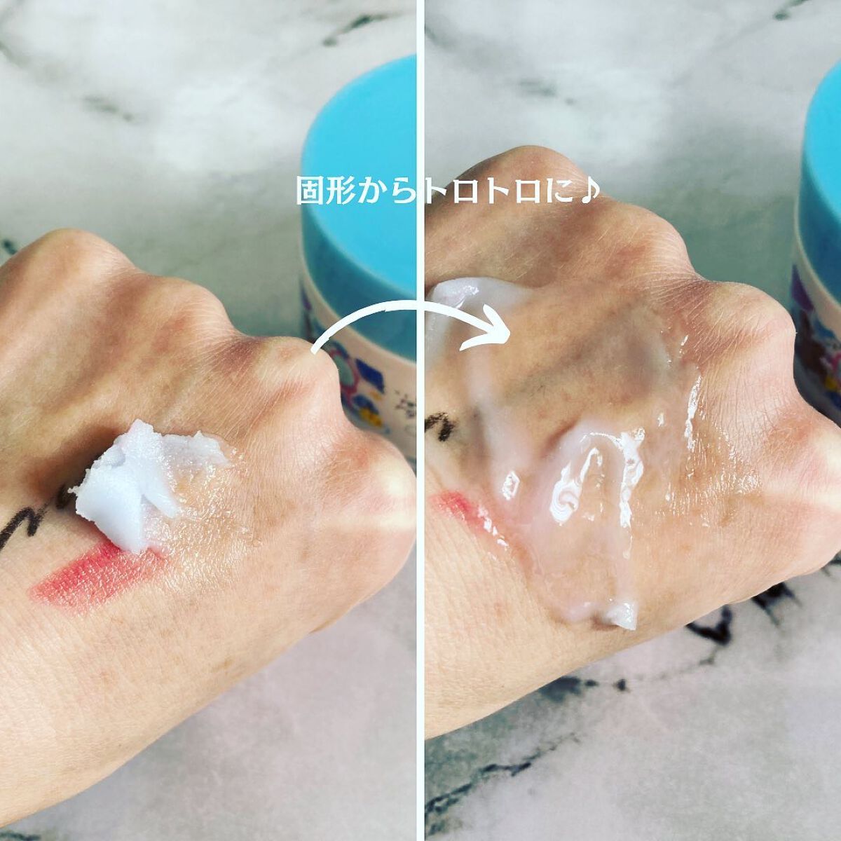 夢みるバーム アクネクリアモイスチャー/ロゼット/クレンジングバームを使ったクチコミ(4枚目)