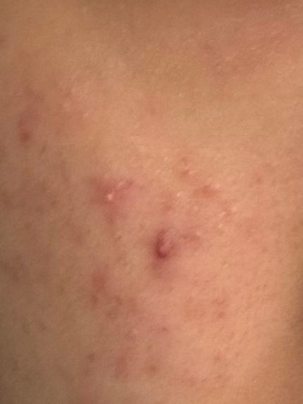 を使ったクチコミ(3枚目)