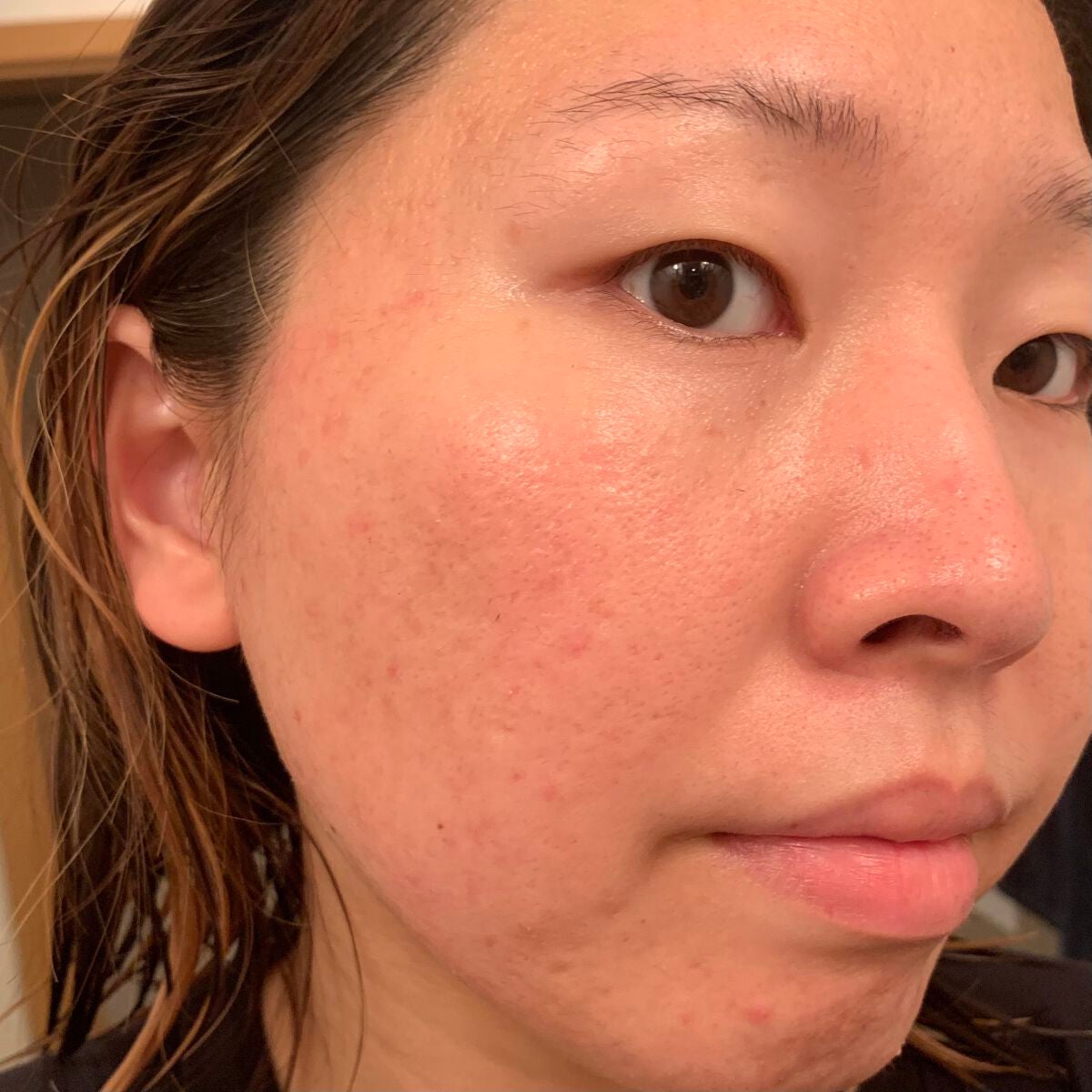 エンリッチ&コンセントレート VCエッセンス/N organic/美容液を使ったクチコミ(7枚目)