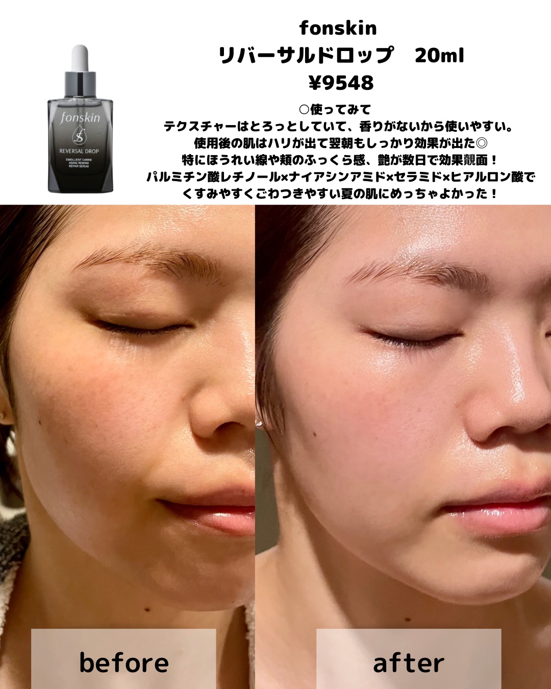 REVERSAL DROP/fonskin/美容液を使ったクチコミ（3枚目）