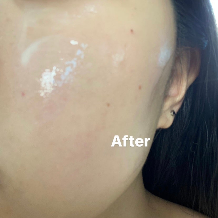 ユース ラディアンス ビタチノール セラム/primera/美容液を使ったクチコミ(7枚目)