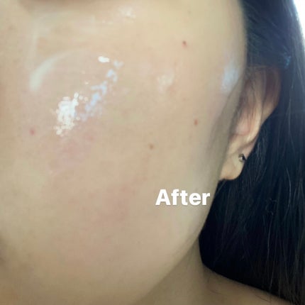 ユース ラディアンス ビタチノール セラム/primera/美容液を使ったクチコミ(7枚目)