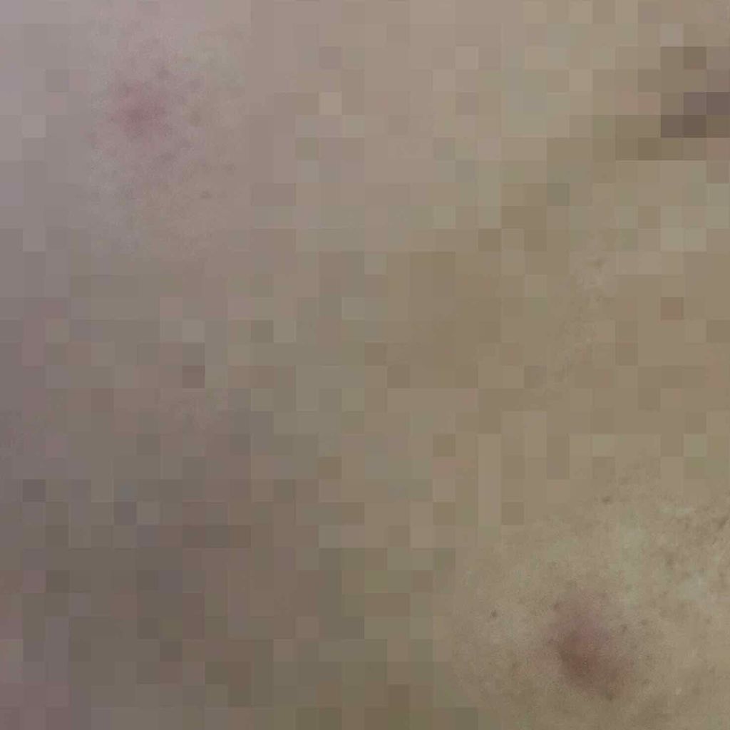 薬用 しみ 集中対策 美容液/メラノCC/美容液を使ったクチコミ（3枚目）