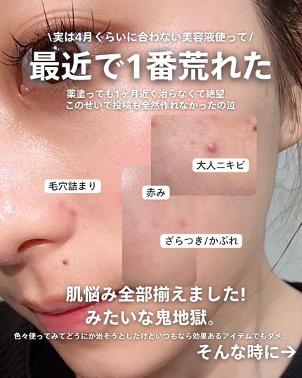 を使ったクチコミ(2枚目)