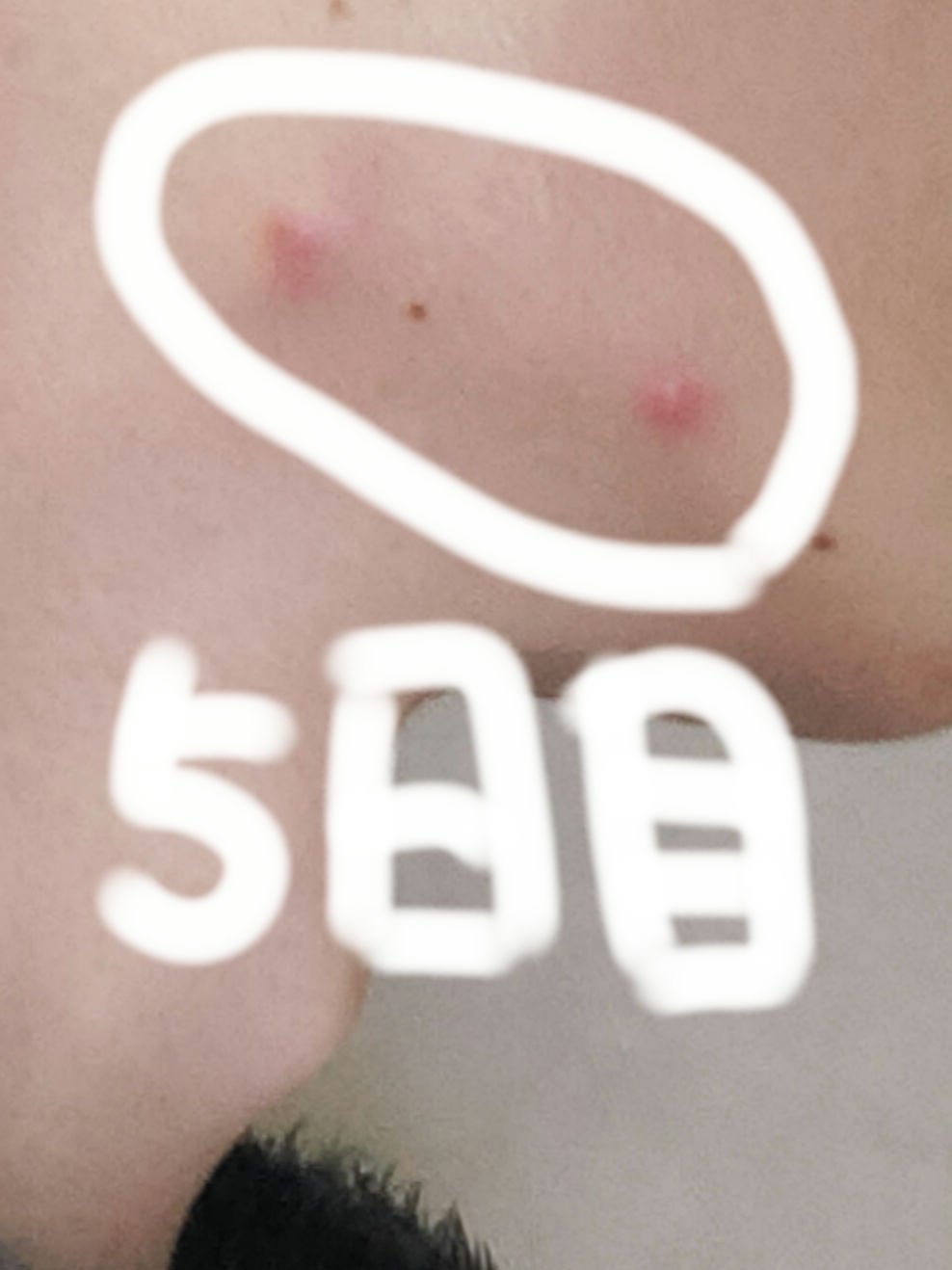 白潤 薬用美白化粧水/肌ラボ/化粧水を使ったクチコミ（1枚目）