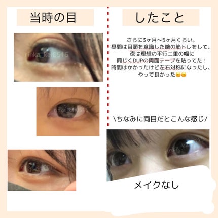 ワンダーアイリッドテープ Extra/D-UP/二重まぶた用アイテムを使ったクチコミ(7枚目)