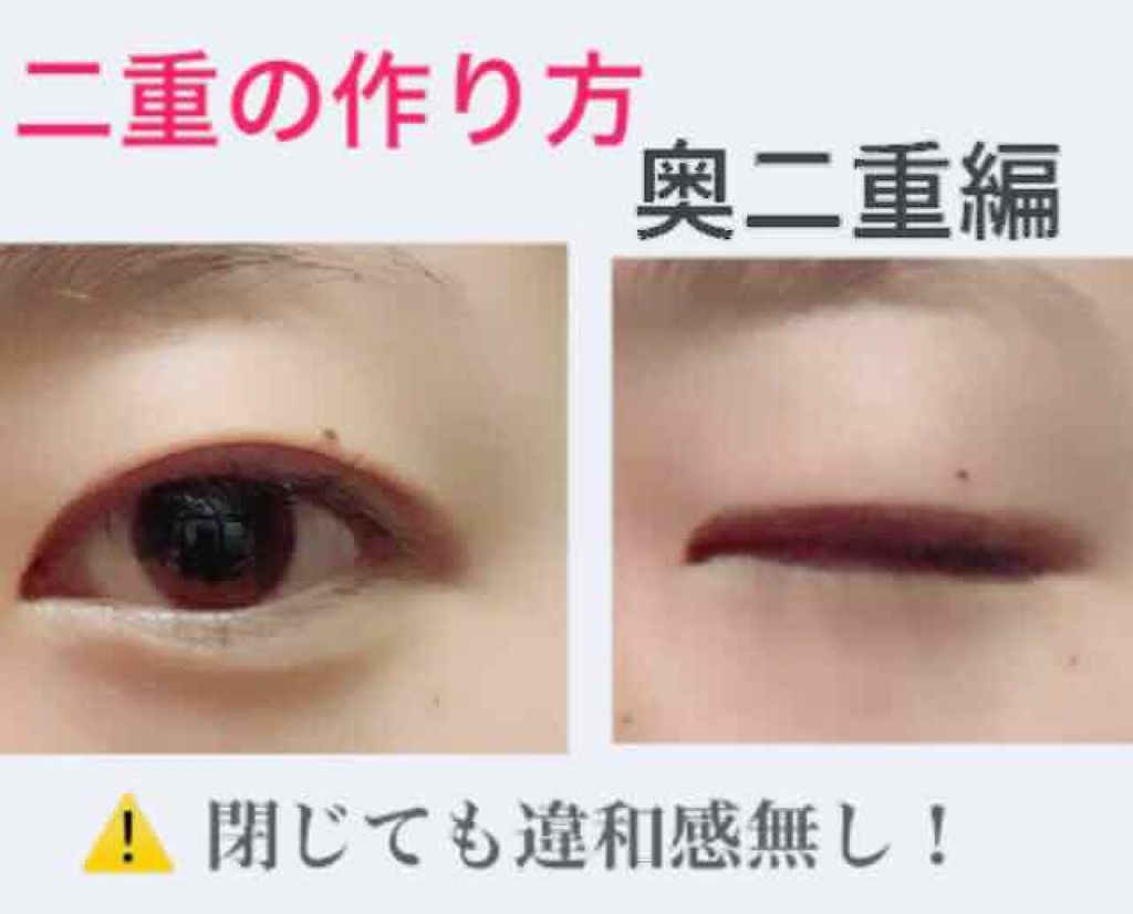 ワンダーアイリッドテープ リタッチボンド/D-UP/二重まぶた用アイテムを使ったクチコミ（1枚目）