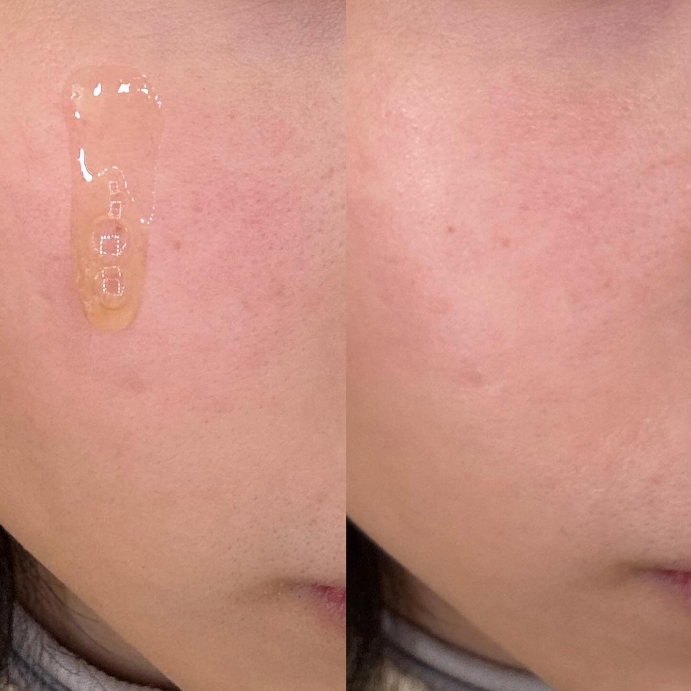 グルタチオングロウアンプル/MEDICUBE/美容液を使ったクチコミ(4枚目)