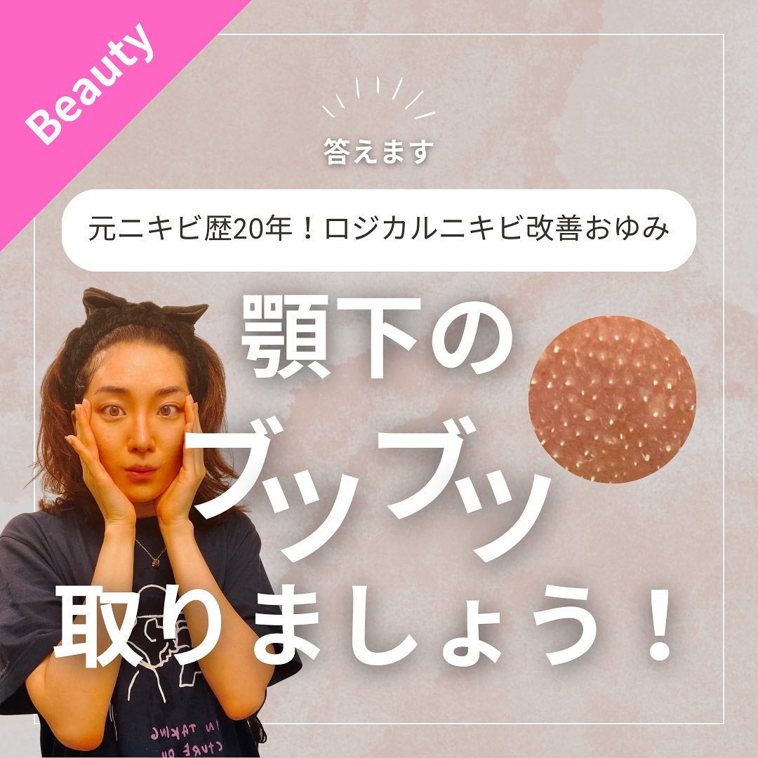 おゆみ|ニキビ・ニキビ跡ケア on LIPS 「@______ohyoume他の投稿【顎下のハリネズミを抹消し..」(1枚目)
