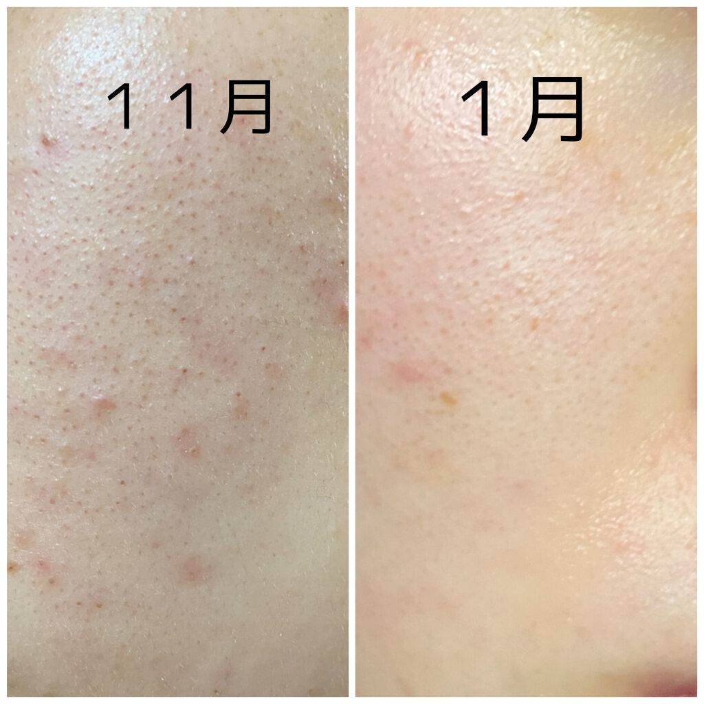 ホホバオイル/無印良品/ボディオイルを使ったクチコミ(2枚目)