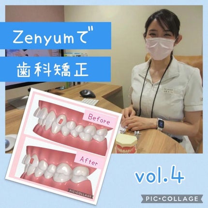みとらん on LIPS 「アラフォーにして歯科矯正を始める事にした私ですが、今回は治療計..」(1枚目)