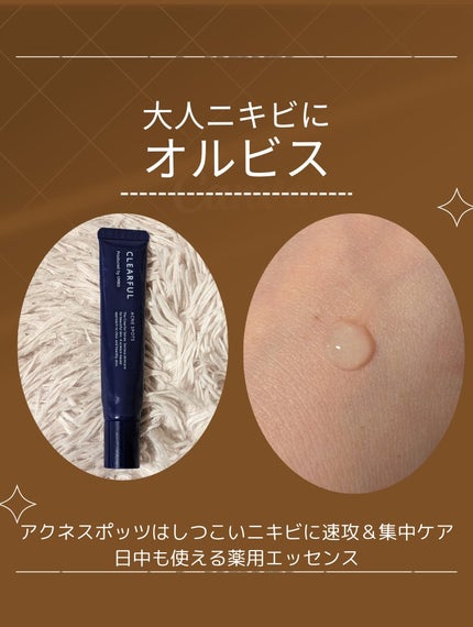オロナインH軟膏 (医薬品)/オロナイン/その他を使ったクチコミ(3枚目)