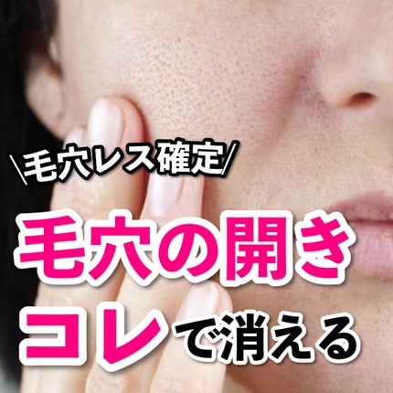 あなたの肌に合ったスキンケア💐コーくん先生 on LIPS 「【早く知りたかった...】たったコレだけで引くほど毛穴消える...」(1枚目)