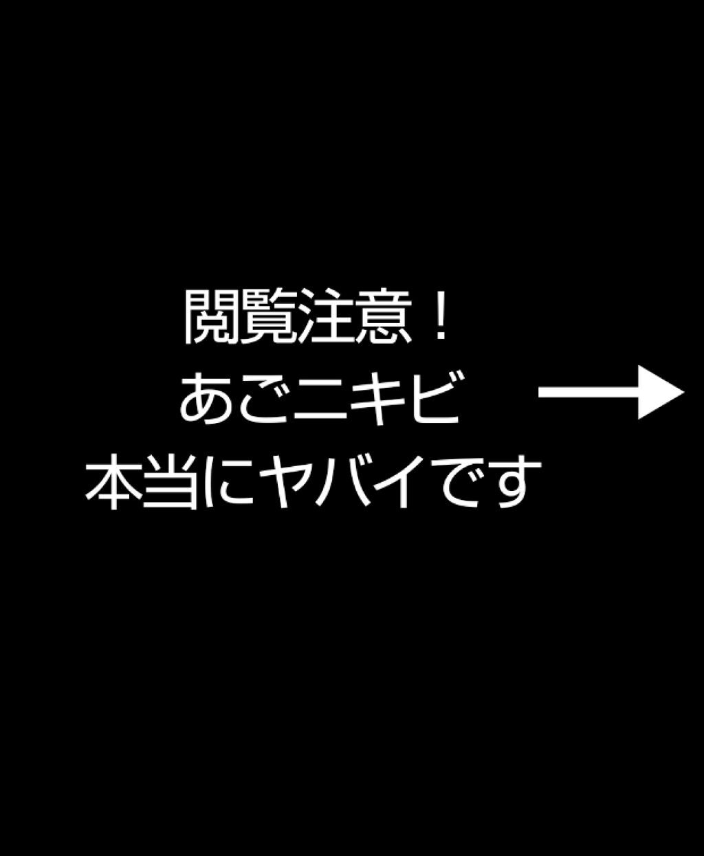 ハトムギ化粧水(ナチュリエ スキンコンディショナー R )/ナチュリエ/化粧水を使ったクチコミ(2枚目)