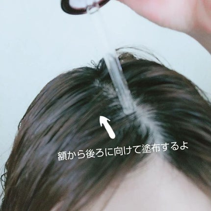 スカルプ リバイタライジングセラム/ヘア&スキン キメア/頭皮ローションを使ったクチコミ(3枚目)