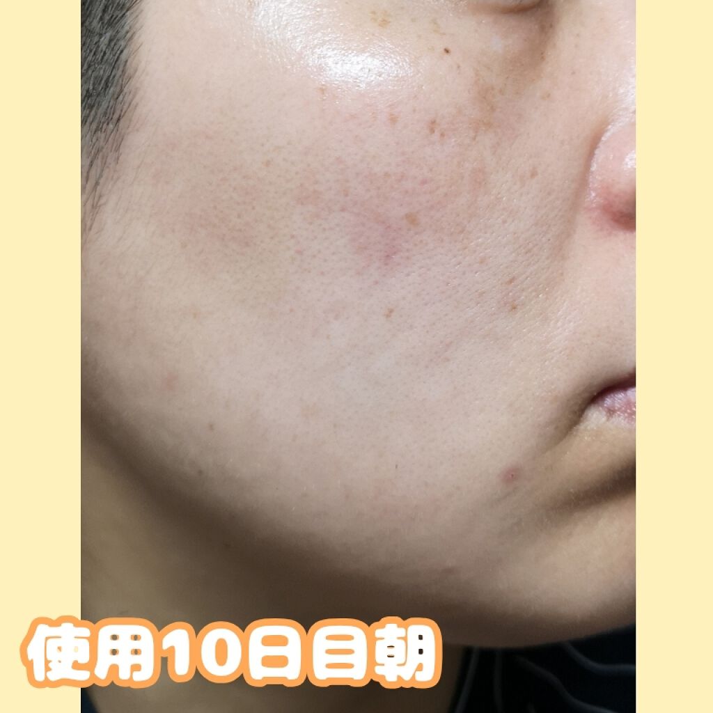 アレルバリア エッセンス BB/d プログラム/BBクリームを使ったクチコミ(2枚目)