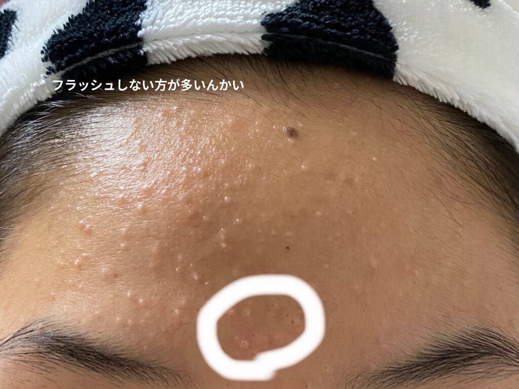 kiho on LIPS 「本気のスキンケアを初めて30日が経ちました!時間って早い、、、..」(3枚目)