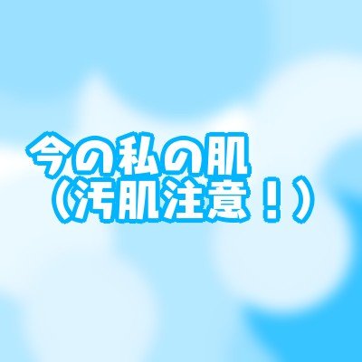 コープ ミルクローションのクチコミ「9/10
4回目
右頬
加工してないのですが部屋の照明で前よりも白っぽく見えますが変わってませ.....」（1枚目）