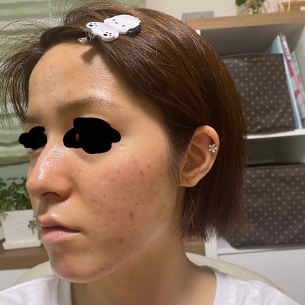 DHC ビタミンCハードカプセル/DHC/美容サプリメントを使ったクチコミ(4枚目)