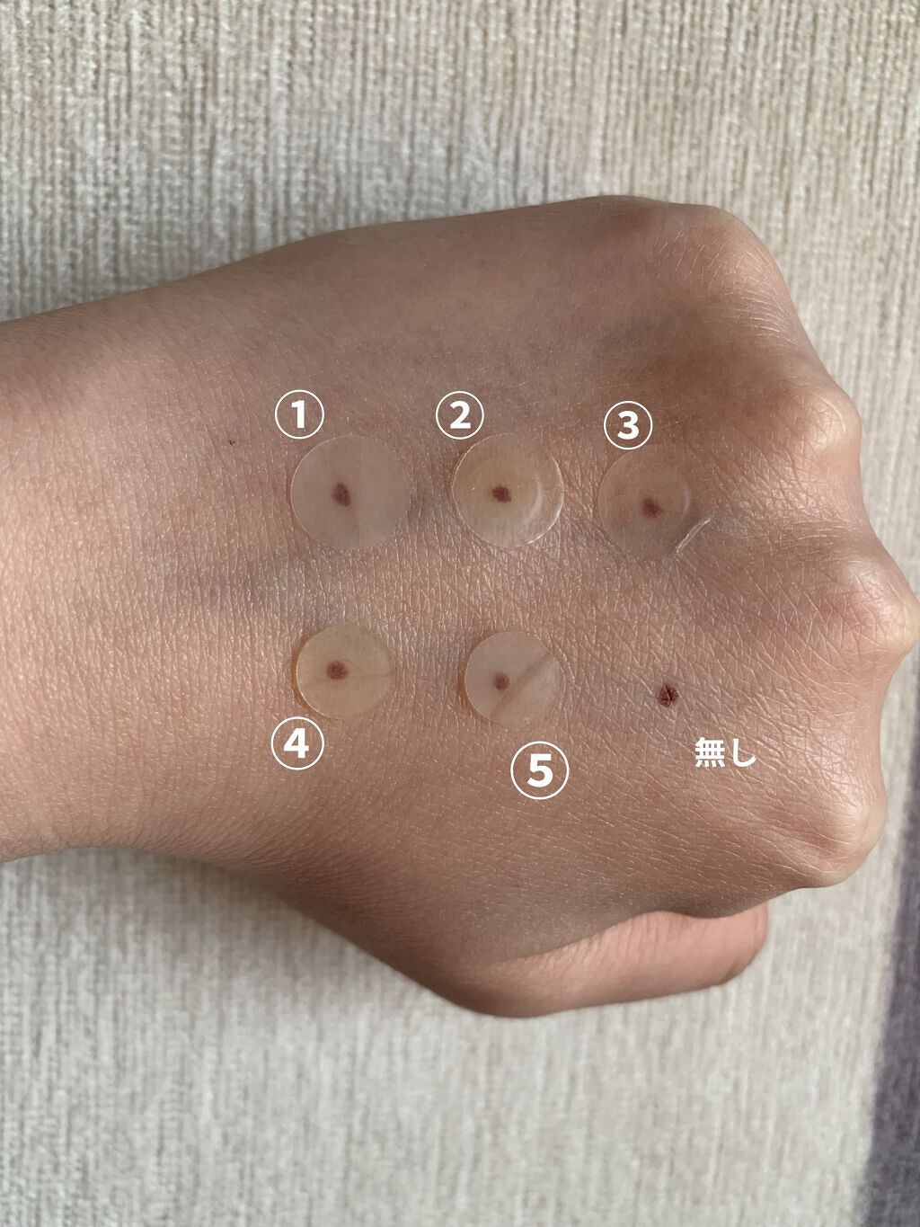 Nexcare/3M nexcare/にきびパッチを使ったクチコミ（2枚目）