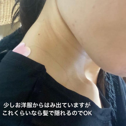 こりキュン 鎮痛消炎ミニ温膏A(医薬品)/グラフィコ/その他を使ったクチコミ(4枚目)