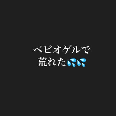 〇〇 on LIPS 「ニキビが治らなすぎてむしろ悪化したので皮膚科へ行きました。最初..」（1枚目）