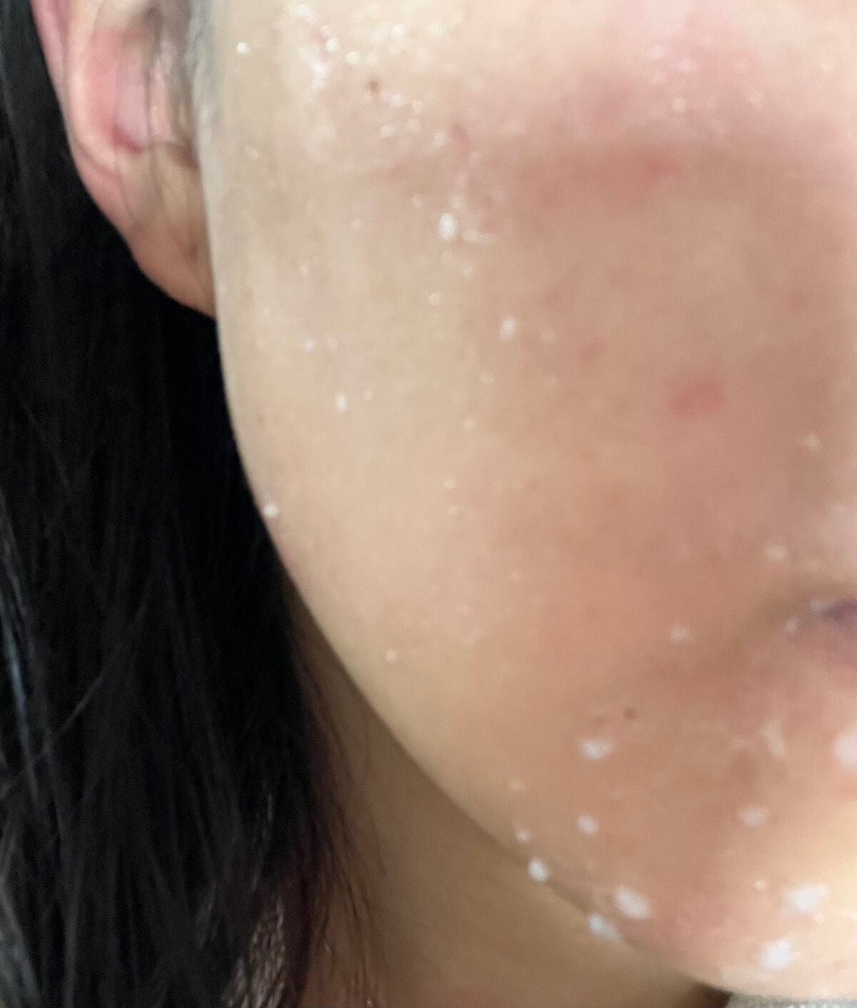 フェイシャルマイルドピーリング/primera/ピーリングを使ったクチコミ(4枚目)