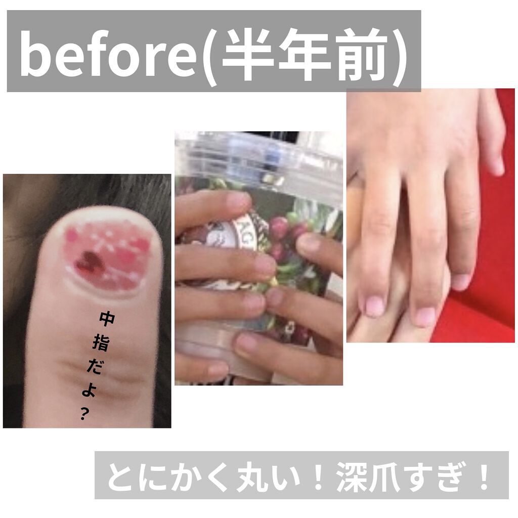 エテュセ クイックケアコート/ettusais/ネイルオイル・トリートメントを使ったクチコミ（2枚目）