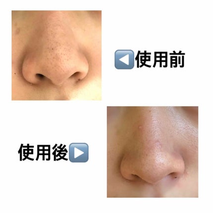 おうちdeエステ 肌をやわららかくする マッサージ洗顔ジェル/ビオレ/その他洗顔料を使ったクチコミ(2枚目)