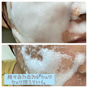 ちゃんぶぅ　投稿ある方フォロバします💕 on LIPS 「BAKER7BubbleEssncePack（ベーカー7バブル..」（3枚目）