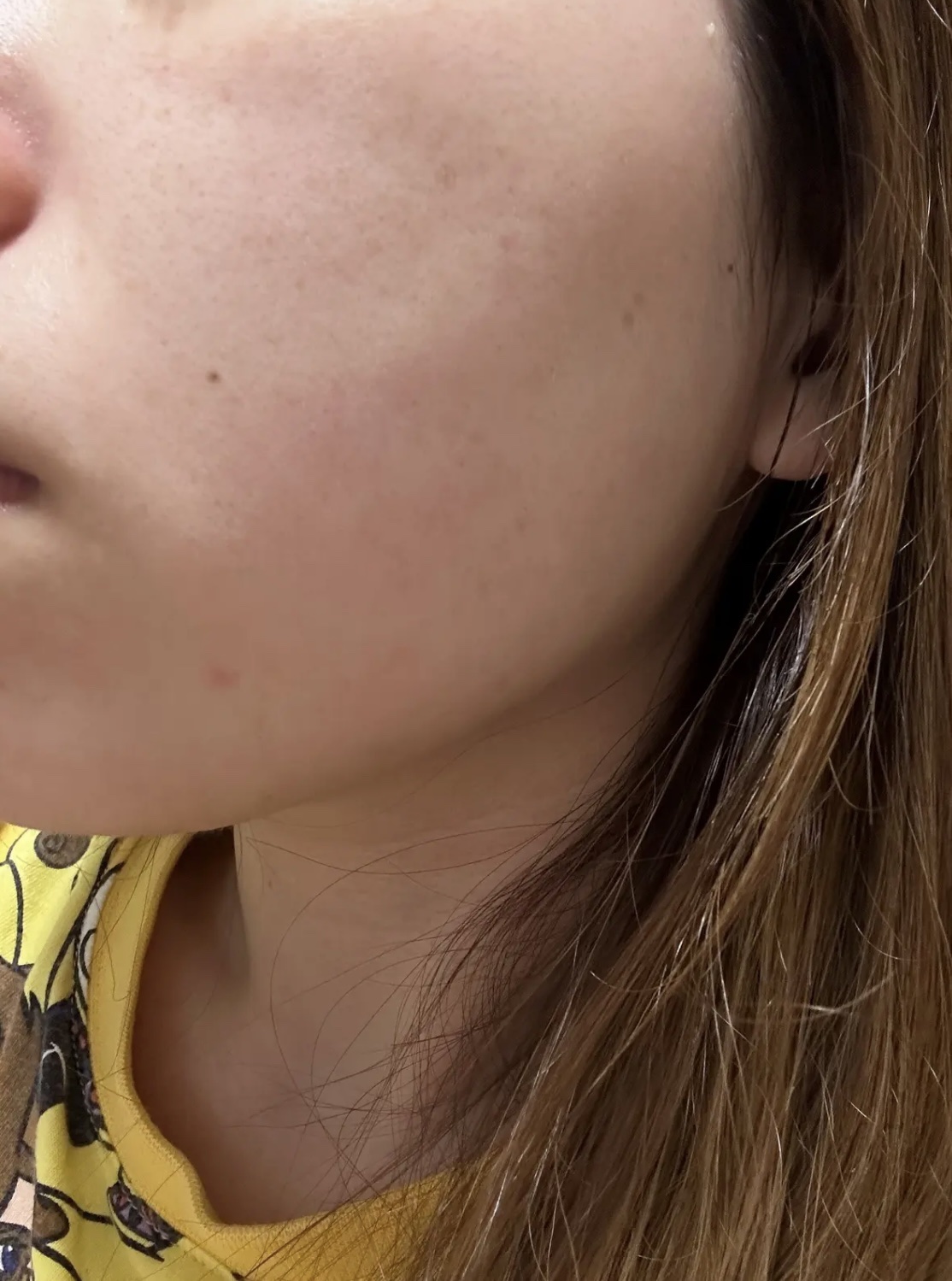 グーダルHCトナーパッド /goodal/トナーパッドを使ったクチコミ（3枚目）