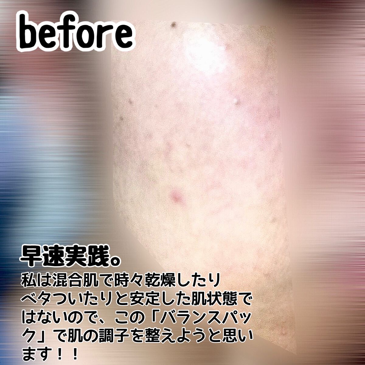 ルルルンピュア エブリーズ/ルルルン/シートマスク・パックを使ったクチコミ(4枚目)