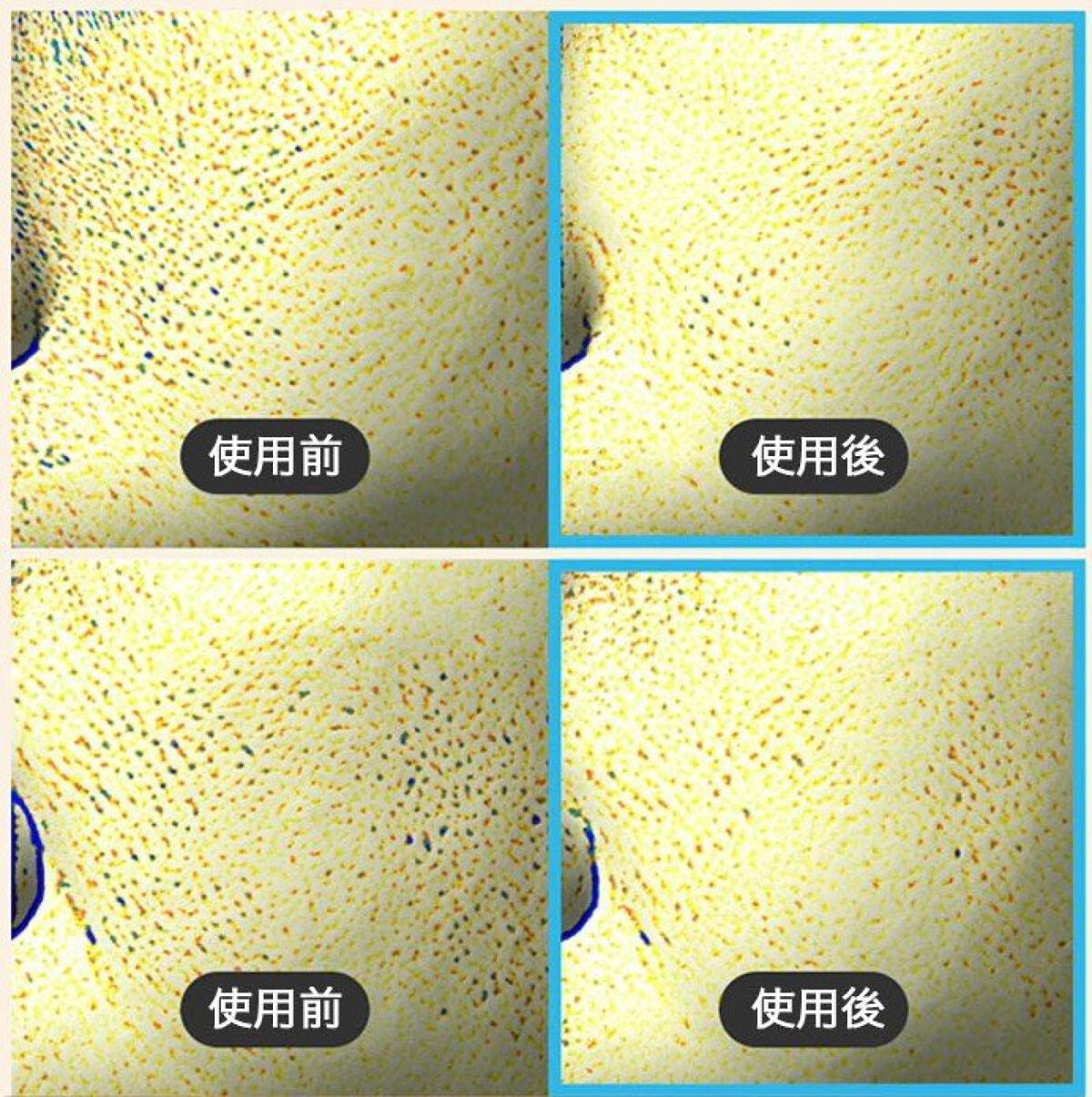 皮脂ごっそり毛穴パック/HANYUL(ハンユル)/洗い流すパック・マスクを使ったクチコミ(2枚目)