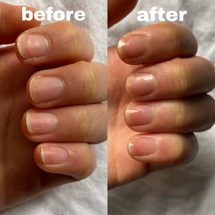 自爪補強コート/デュカート/ネイルベースコートを使ったクチコミ(2枚目)