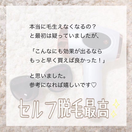 光脱毛器 VIO/Sarlisi/家庭用脱毛器を使ったクチコミ(8枚目)