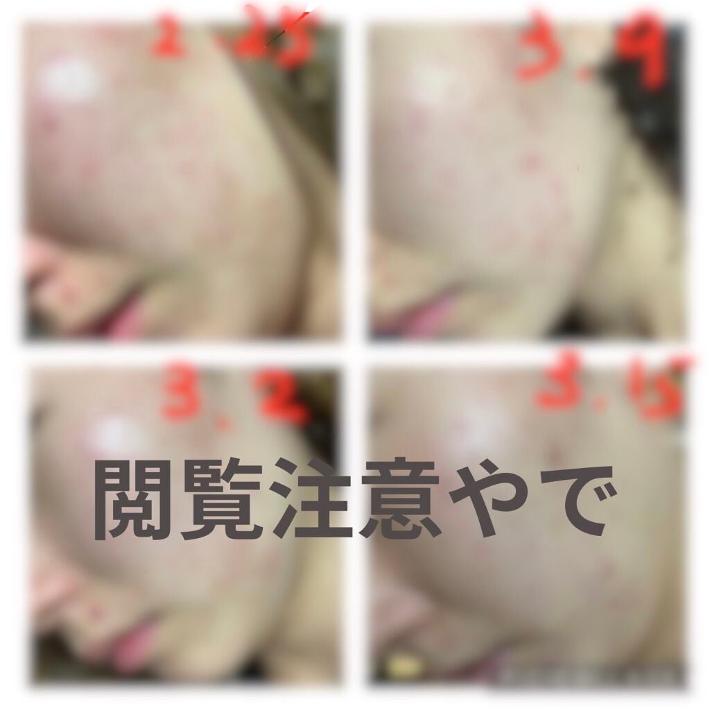 クリアウォッシュ/オルビス/洗顔フォームを使ったクチコミ(1枚目)