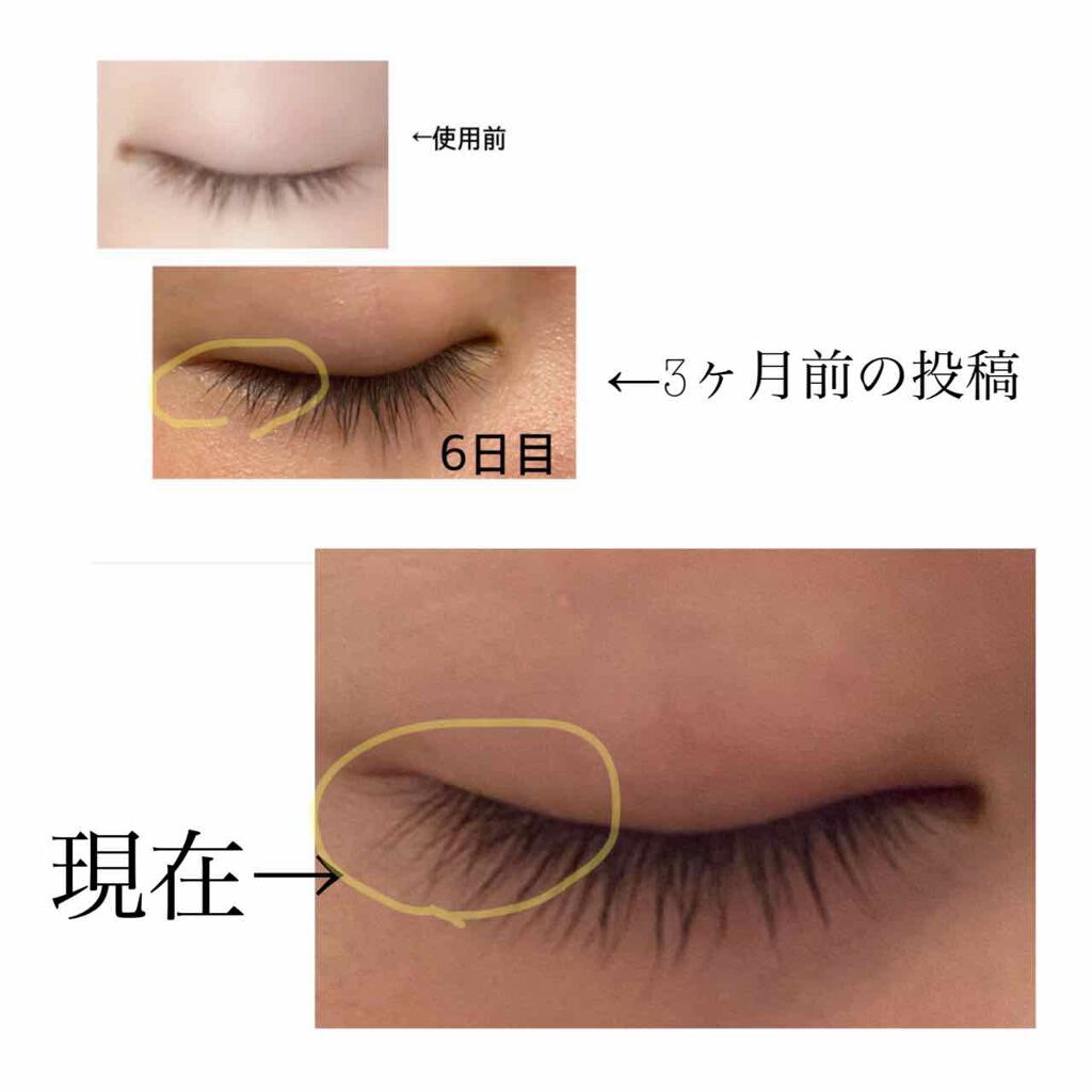 スカルプD ボーテ ピュアフリーアイラッシュセラム/アンファー(スカルプD)/まつげ美容液を使ったクチコミ(2枚目)