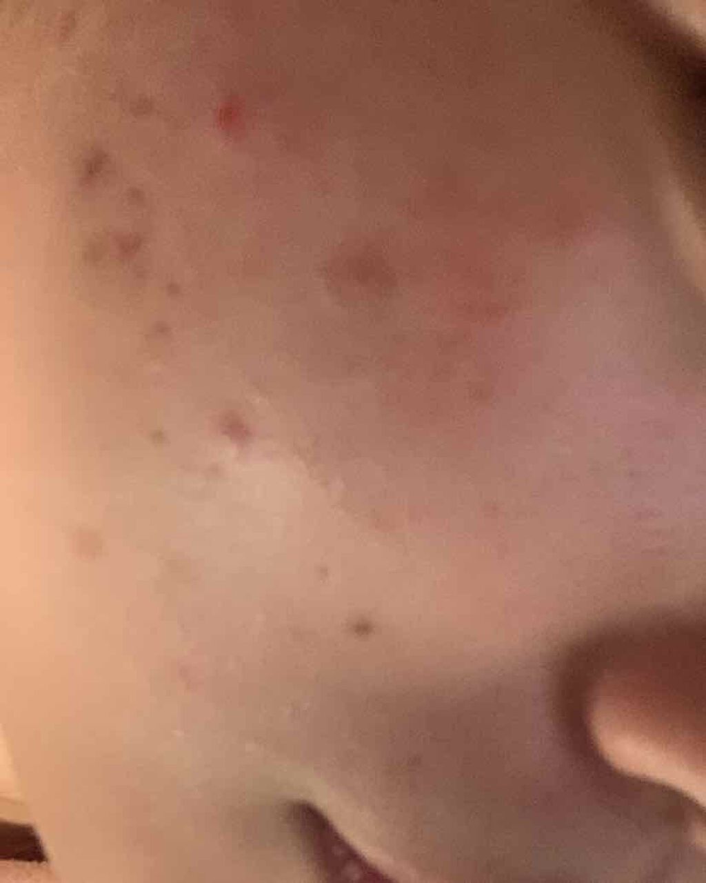 ロゼット洗顔パスタ アクネクリア/ロゼット/洗顔フォームを使ったクチコミ(2枚目)