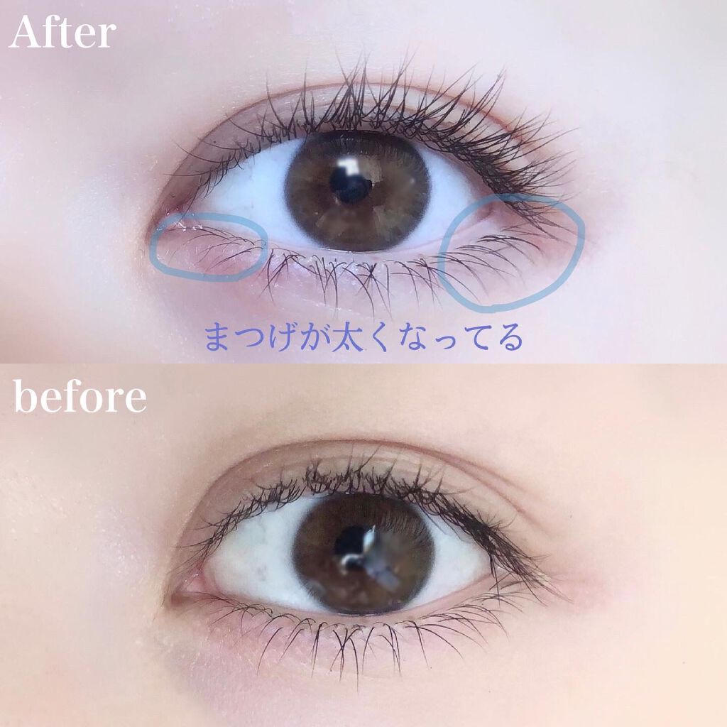 アイラッシュセラム まつげ美容液/ABEAGEN/まつげ美容液を使ったクチコミ(2枚目)