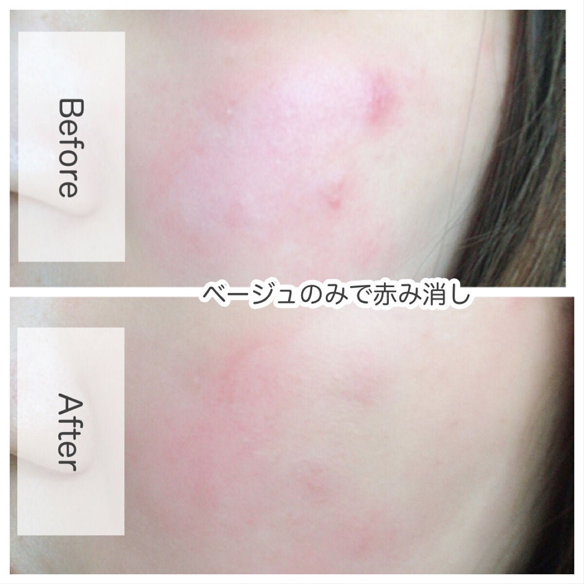 リシェ レッドトリック アイコンシーラー/Visée/パレットコンシーラーを使ったクチコミ(5枚目)