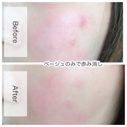 リシェ レッドトリック アイコンシーラー/Visée/パレットコンシーラーを使ったクチコミ(5枚目)