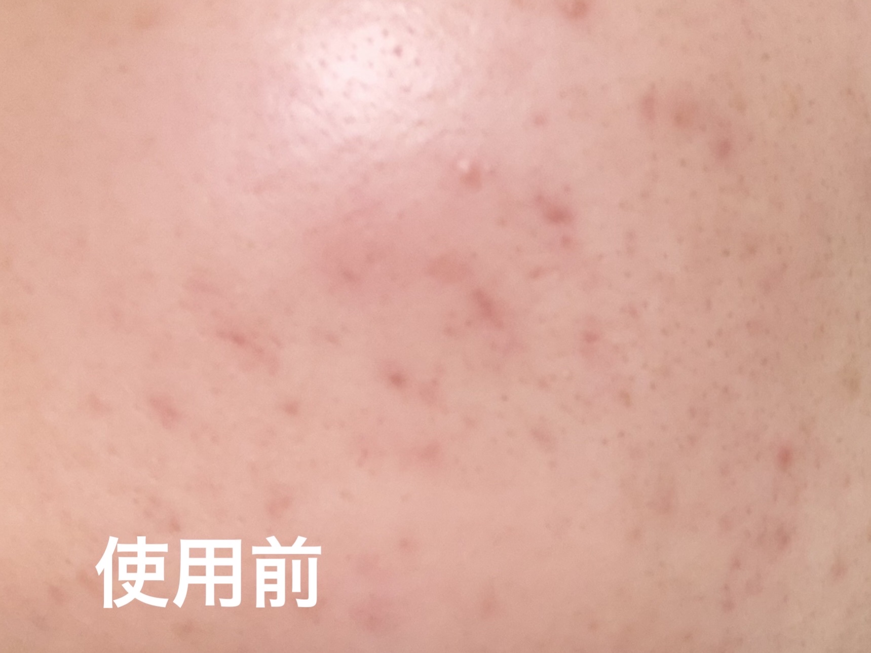 スムースEクリーム/SMOOTH E/フェイスクリームを使ったクチコミ（2枚目）